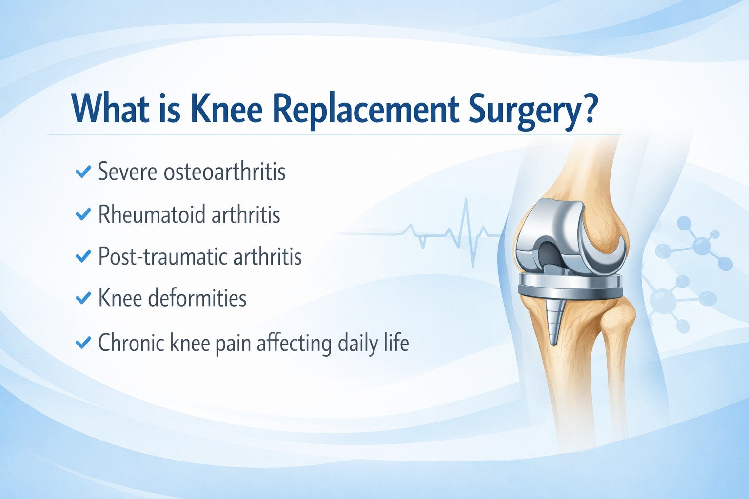 What is Knee Replacement Surgery?