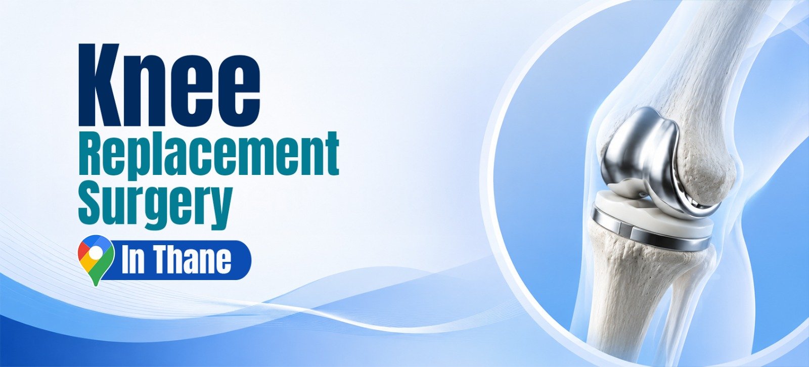 Knee Replacement Surgery in Navi Mumbai – Advanced Joint Replacement by Dr. Sourabh Kulkarni
